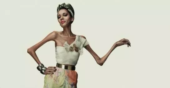 Mannequins anorexiques, la campagne choc d'une agence brésilienne